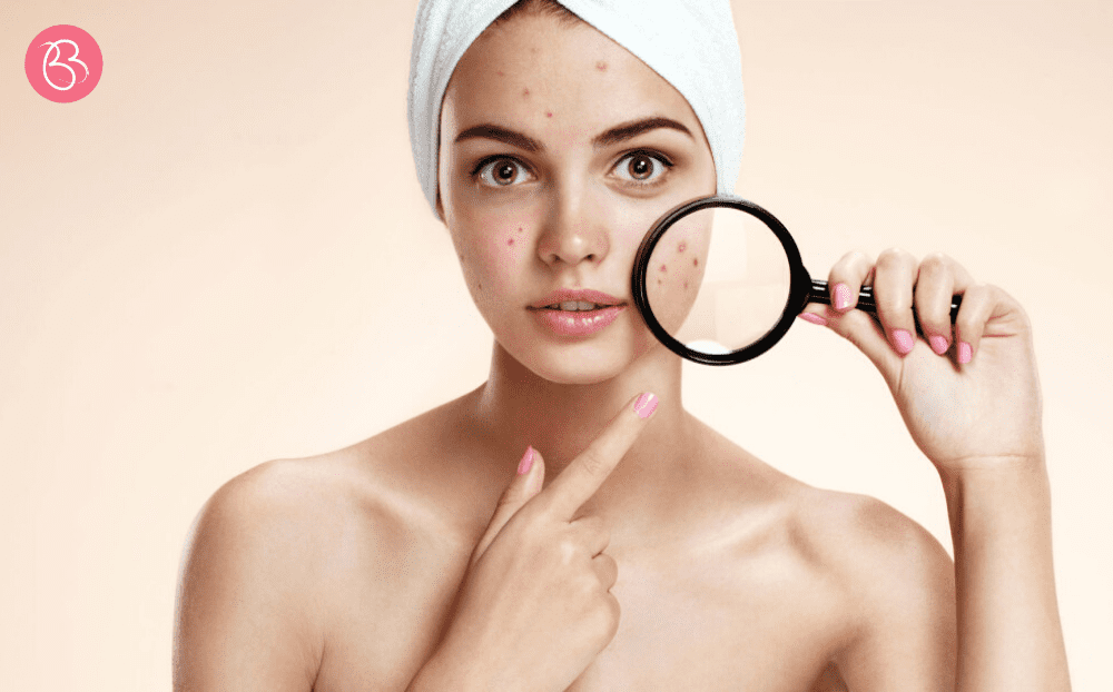 5 astuces contre les imperfections du visage - Bio&Beauty™